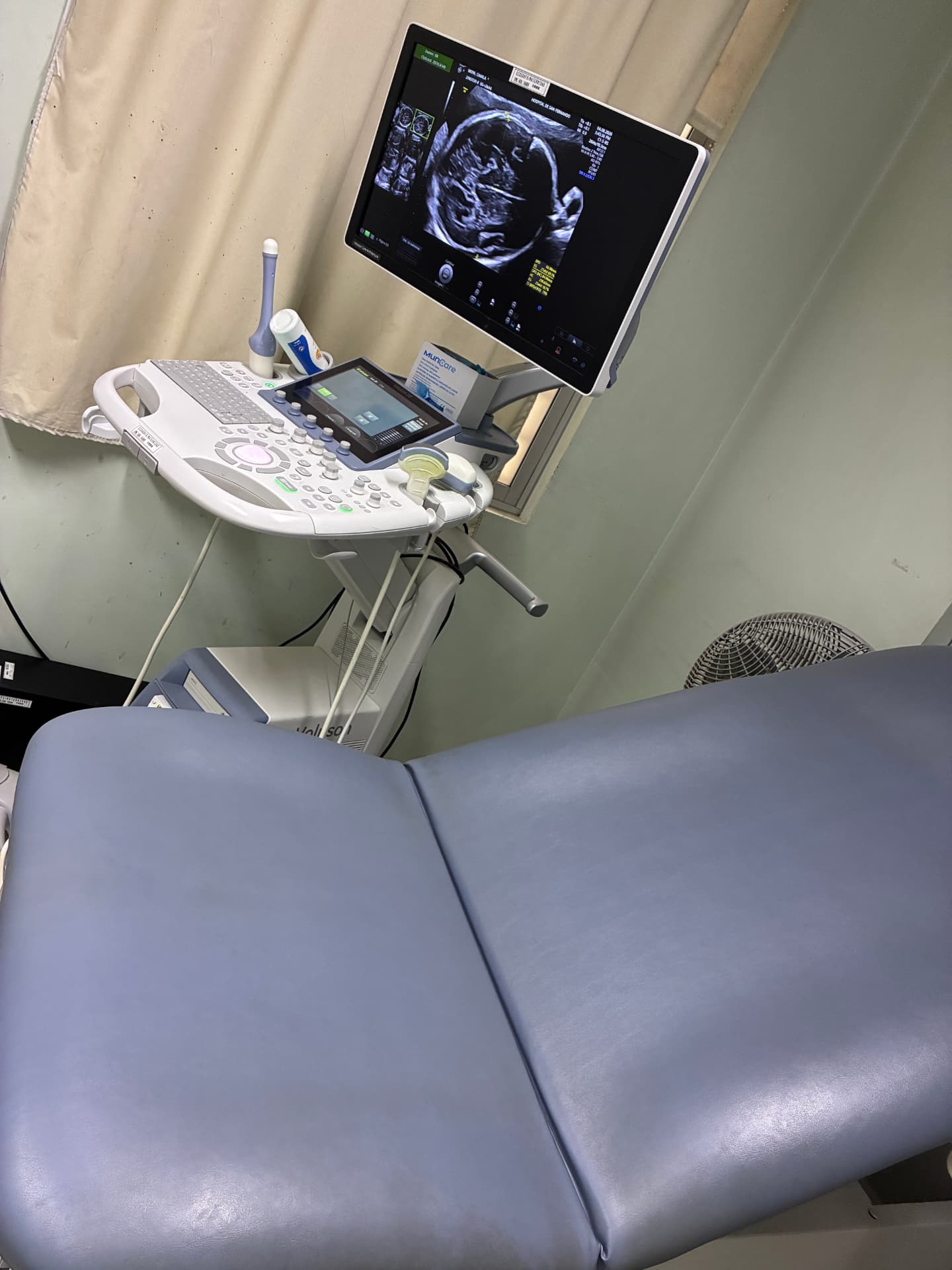 Unidad de ultrasonido obstétrico del Servicio de OB-GIN, Hospital San Fernando.